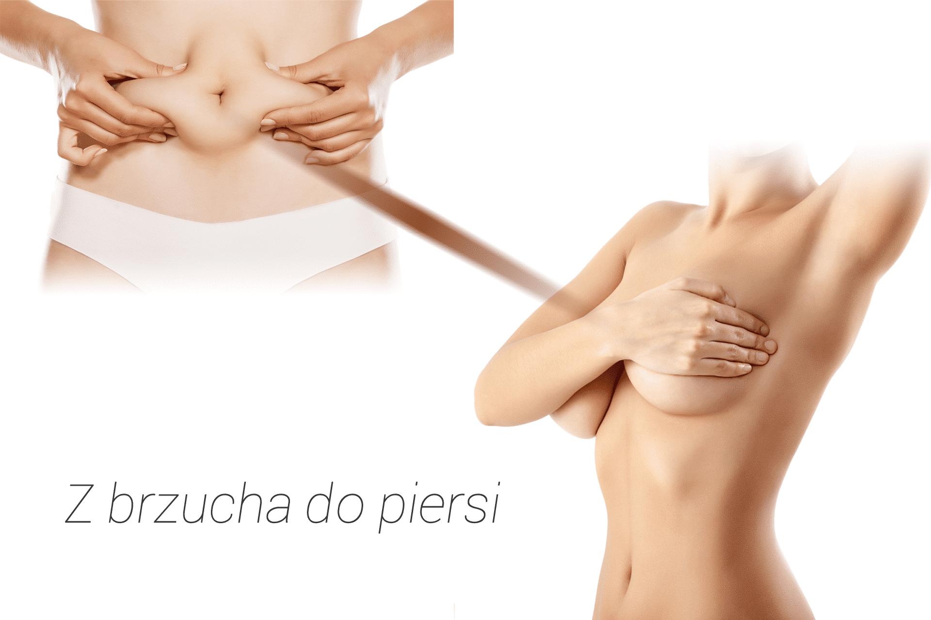 powiększenie piersi tkanką tłuszczową w gabinecie medycyny estetycznej Derm-Estetyka w Gdyni