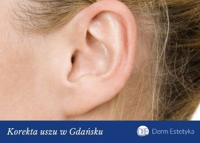 Korekta uszu Gdańsk - Derm Estetyka 