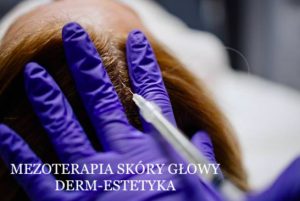 Mezoterapia na włosy Gdynia