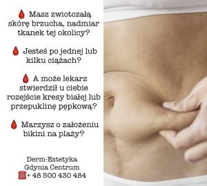 Abdominoplastyka Gdańsk
